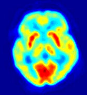 Brain scanning geneeskunde