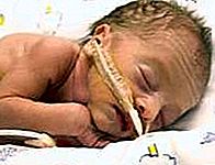 Sindrom nenadne smrti dojenčka
