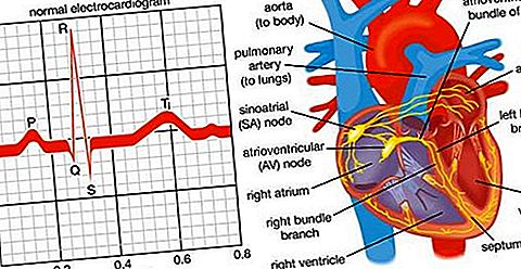 Sisteminė širdies funkcija