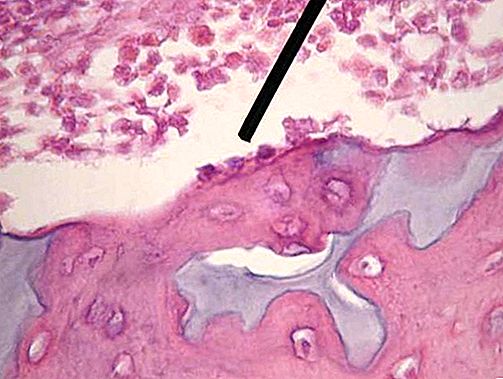 Células de osteoblastos