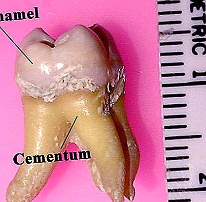 エナメル歯