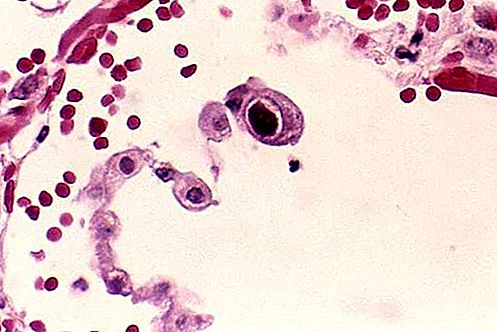 Citomegalovirus virus
