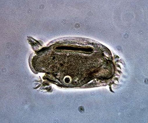 Protozoo entodiniomorfo