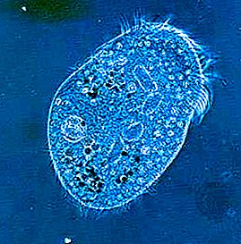 Hypotrich protozoan
