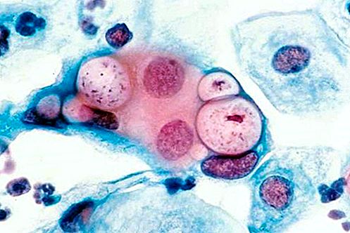 Chlamydia-Mikroorganismus