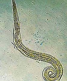 Pinworm nematode