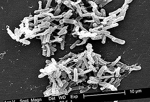 Bacteria Clostridium