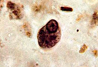 Entamoeba protozoa geslacht