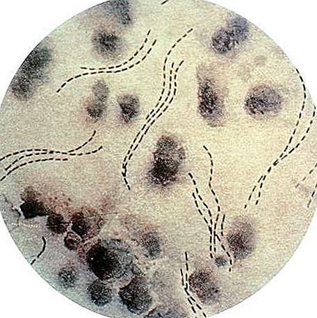 Rod bakterija Haemophilus